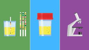 How To Take a Home Drug Test