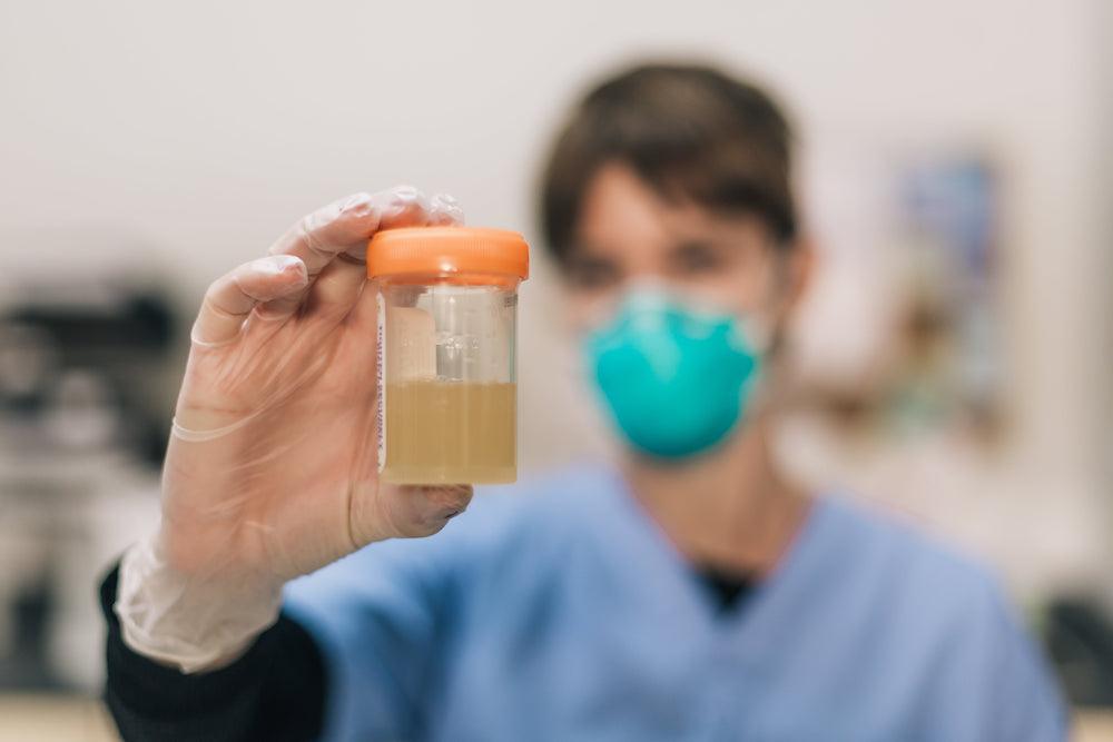 drug test sample tested in lab with u-test 
